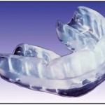 Profesionalni ščitnik za zobe ''PROTEXSMILE''